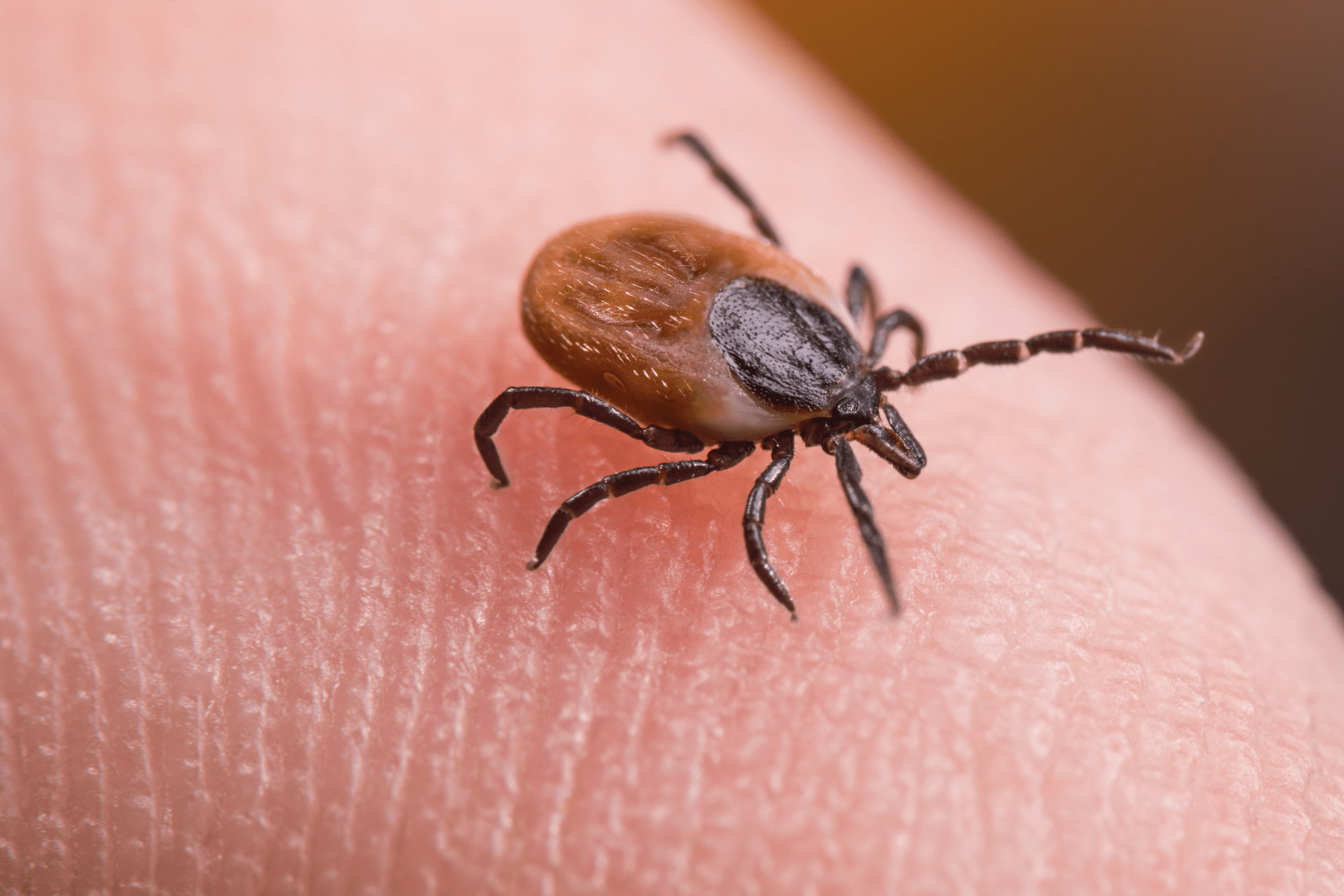 Erikinio encefalito tyrimas Altamedica